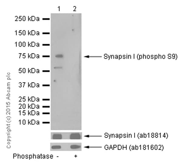 Synapsin I Phospho S9 Antibody Ep2162y Ab76260  Western Blot Img19040