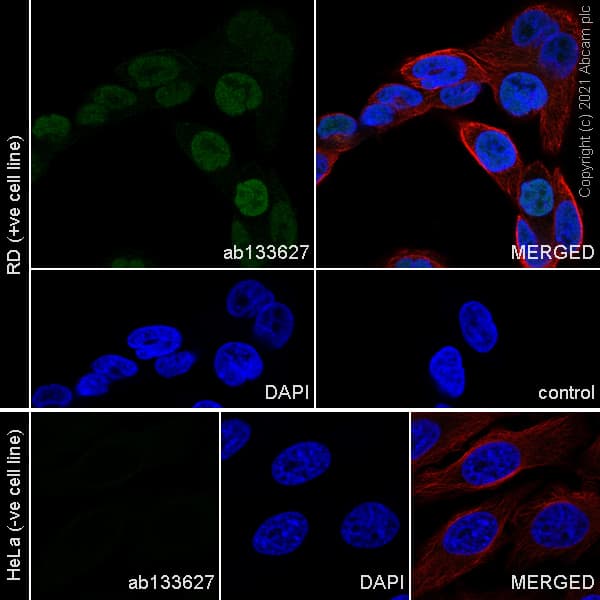 Anti-MyoD1 antibody [EPR6653-131](AB133627)