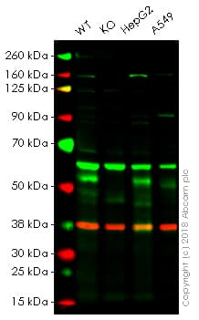 Anti-FOXA1 antibody(AB23738)