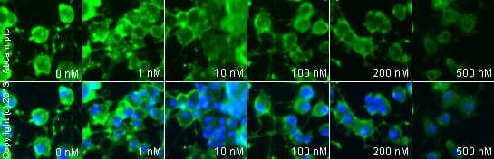 Anti-Tyrosine Hydroxylase antibody(AB6211)