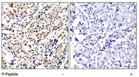 Chk1 Phospho S345 Antibody Ab47318  Immunohistochemistry Formalin Pfa Fixed Paraffin Embedded Sections Img93650