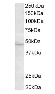 Tmprss4 Antibody Ab82176  Western Blot Img100035