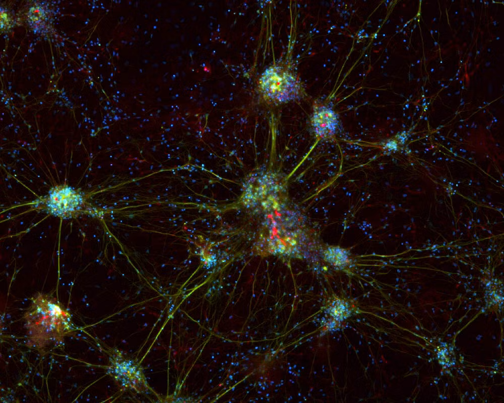 Experiment Neurond Max Proj 10 Kid21763728