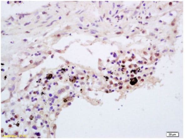 Tnfaip3 Antibody Ab217706  Immunohistochemistry Formalin Pfa Fixed Paraffin Embedded Sections Img45214