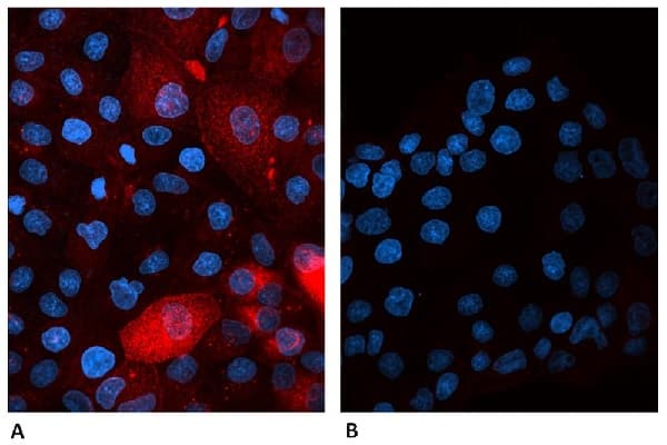 Alexa Fluor 647 Beta 2 Microglobulin Antibody B2m01 Ab187602  Immunocytochemistry Immunofluorescence Img93949