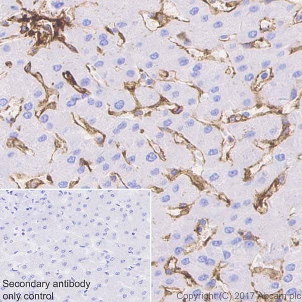 Anti-CD39 antibody [EPR20627](AB223842)