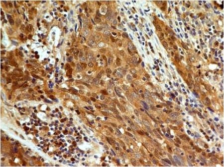 Caspase 3 Antibody Abm1c12 Ab208161  Immunohistochemistry Formalin Pfa Fixed Paraffin Embedded Sections Img130952