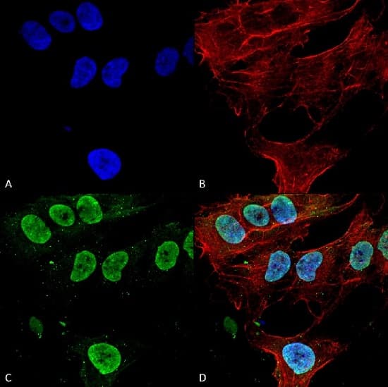 Cacna1g Antibody N178a 9 Ab134269  Immunocytochemistry Immunofluorescence Img110386