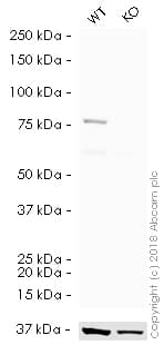 HRP Anti-Calnexin antibody [EPR3633(2)] - ER Membrane Marker(AB195198)