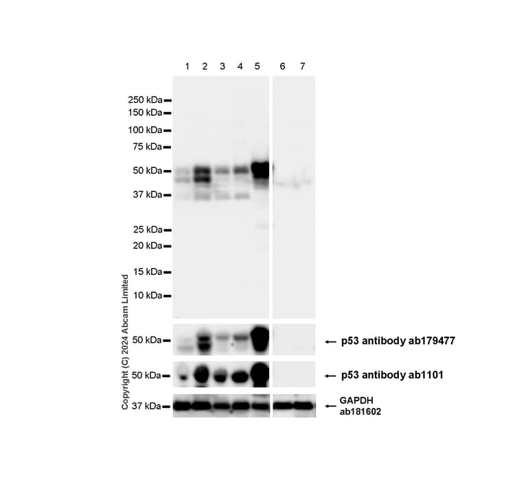 Anti-p53 antibody [DO-1] - ChIP Grade(AB1101)