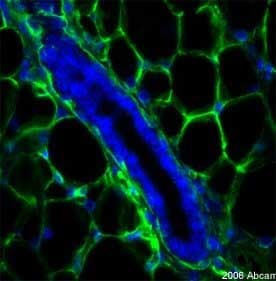 Anti-Collagen IV antibody(AB19808)