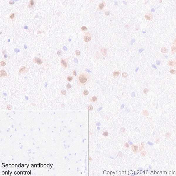 Anti-HuD + HuC antibody [EPR19098](AB184267)