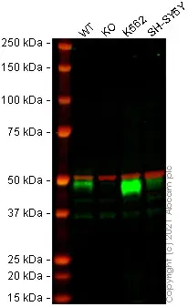 Anti-TGF beta 1 antibody [EPR21143](AB215715)
