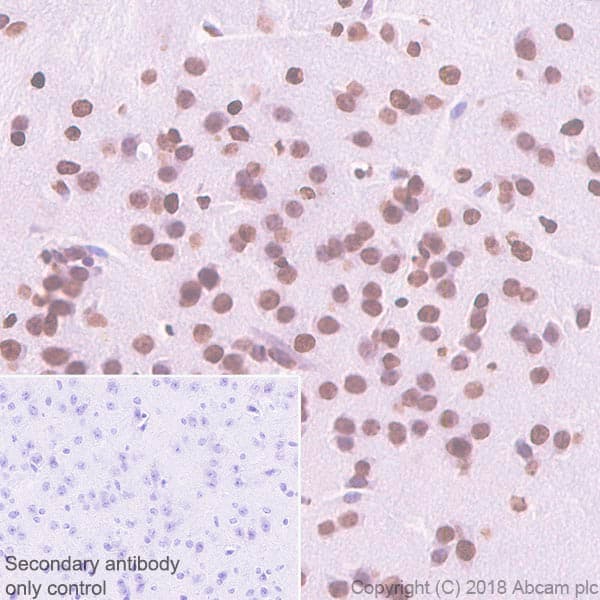 Anti-Histone H2A.Z antibody [EPR6171(2)(B)] - ChIP Grade(AB150402)