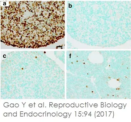 TUNEL Assay Kit - HRP-DAB(AB206386)