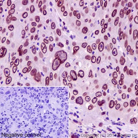 Anti-Lamin A + Lamin C antibody [EPR4100] - Nuclear Envelope Marker(AB108595)