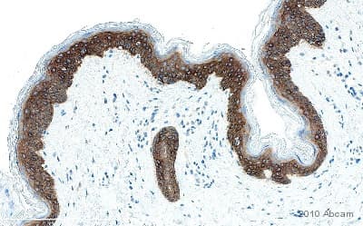 Anti-Cytokeratin 14 antibody [LL002](ab7800)
