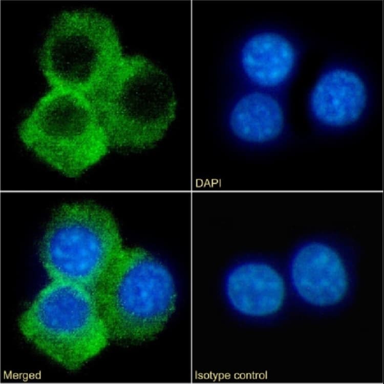 Anti-CD70 antibody [TAN1-6](AB281908)