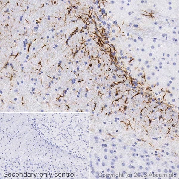 Biotin Gfap Antibody Epr1034y Astrocyte Marker Ab314264  Immunohistochemistry Formalin Pfa Fixed Paraffin Embedded Sections Img421977