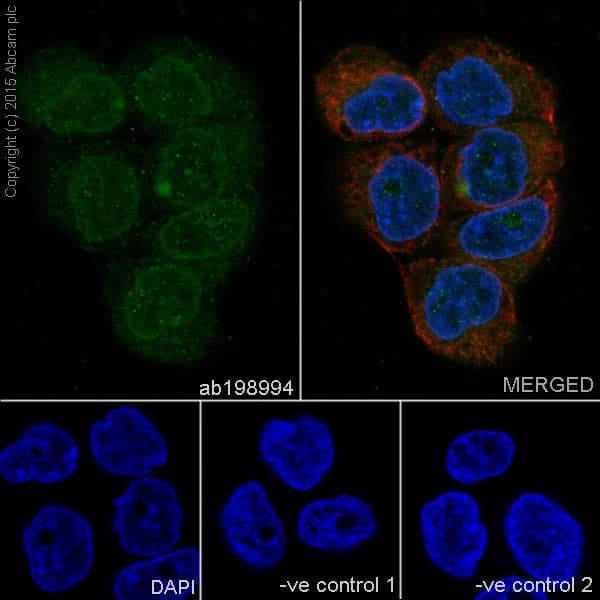 Loricrin Antibody Epr71492 C Terminal Ab198994  Immunocytochemistry Immunofluorescence Img73127