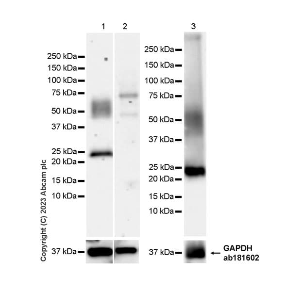 Anti-RS1 antibody [EPR28513-78](AB314231)