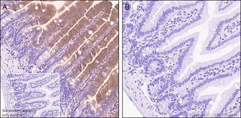 Anti-GSDMD antibody [EPR20859](AB219800)
