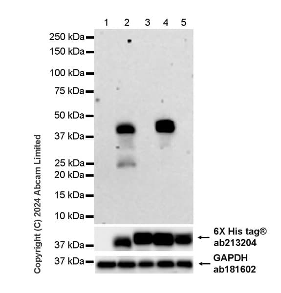 Western%20blot%20 %20anti Hepatitis%20b%20virus%20surface%20antigen%20(Ayw%20and%20ayr)%20antibody%20[2d11]%20(Ab319998)  Western Blot Img440370