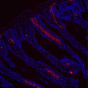 Anti-LYVE1 antibody - BSA and Azide free(AB14917)