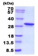 Recombinant human Carbonic Anhydrase 1/CA1 protein(AB208320)