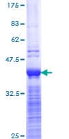 Recombinant Human MRP2 protein(AB112272)