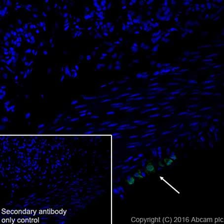 Anti-HuD + HuC antibody [EPR19098](AB184267)