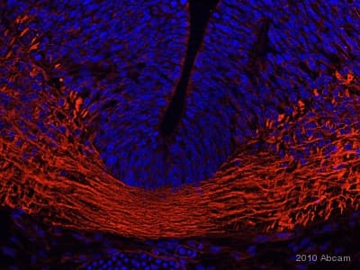 Anti-beta III Tubulin antibody [TU-20] - Neuronal Marker(ab7751)