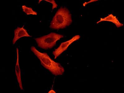 Anti-RENT1/hUPF1 antibody [EPR4681](AB109363)