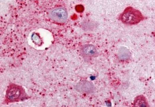 Anti-Somatostatin Receptor 2 antibody - Cytoplasmic domain(AB189080)