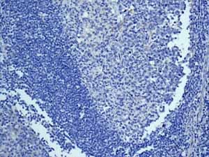 Cytochrome P450 4a Cyp4a11 Antibody Epr8276 Bsa And Azide Free Ab248918  Immunohistochemistry Formalin Pfa Fixed Paraffin Embedded Sections Img95834