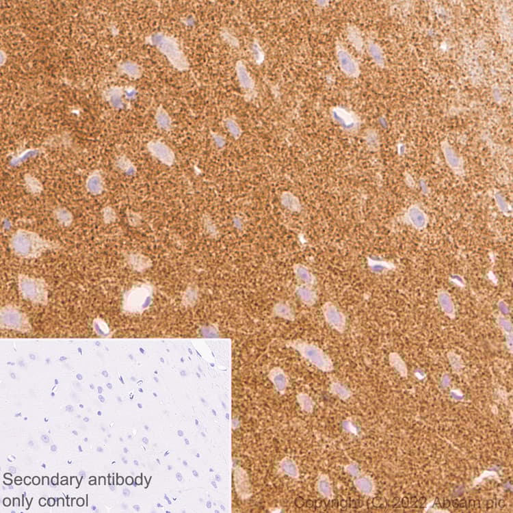 Anti-Bassoon/BSN antibody [L124-59](AB306593)