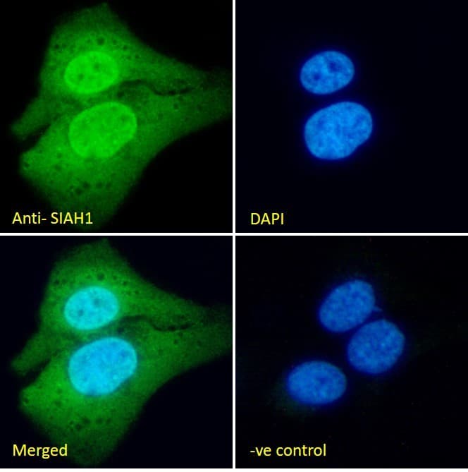 Siah1 Antibody Ab2237  Immunocytochemistry Immunofluorescence Img403702