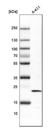 Tagln2 Antibody Ab121146  Western Blot Img28355
