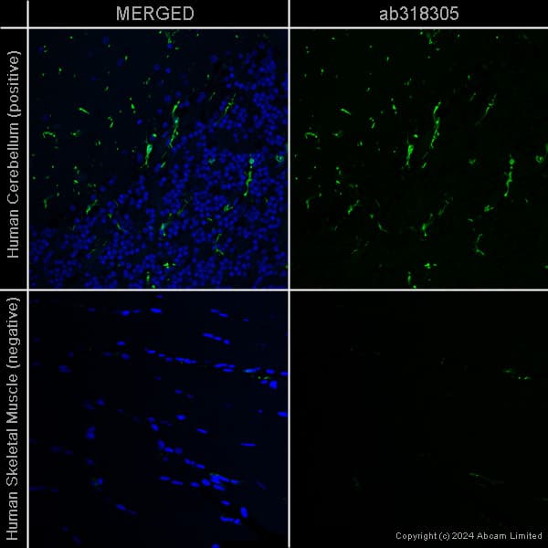 Anti-Iba1 antibody [EPR16588] – Chicken IgY (Chimeric)(AB318302)