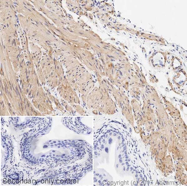 Anti-TAGLN/Transgelin antibody [EPR21206](AB213273)