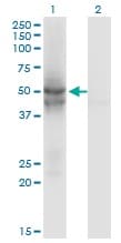 Idh2 Antibody 5f11 Ab55271  Western Blot Img145930