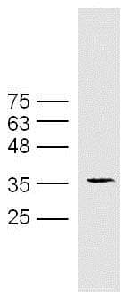 Anti-HLA E antibody(AB203082)