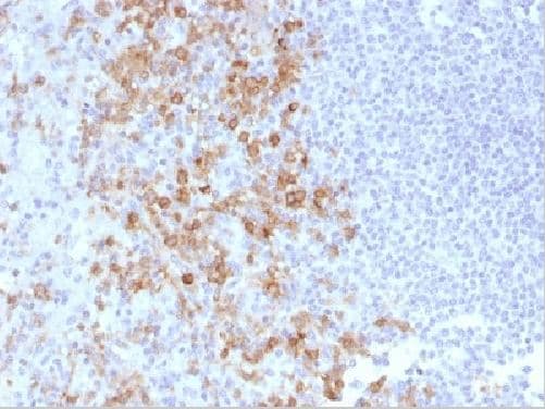 Psgl 1 Antibody Psgl1 1601 Ab218518  Immunohistochemistry Formalin Pfa Fixed Paraffin Embedded Sections Img36313