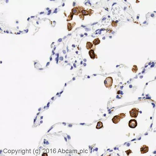 Anti-Mannose Receptor antibody(AB64693)