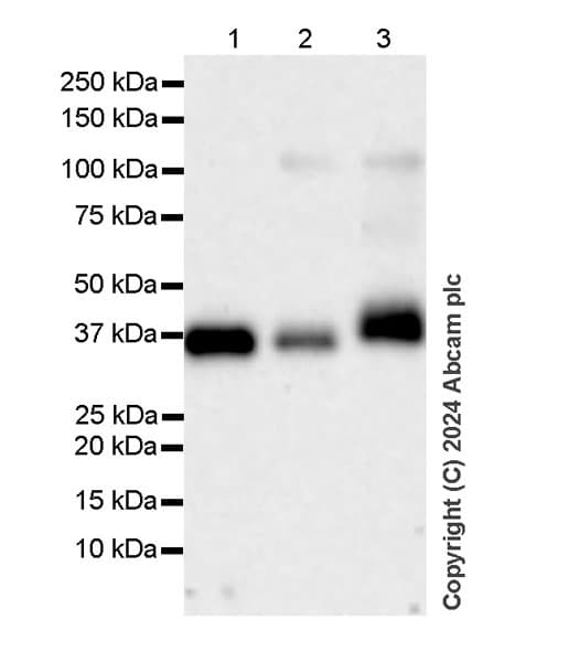 Anti-HLA Class 1 abC antibody [EMR8-5](ab70328)