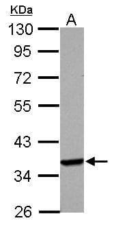 Anti-Langerin antibody(AB272895)