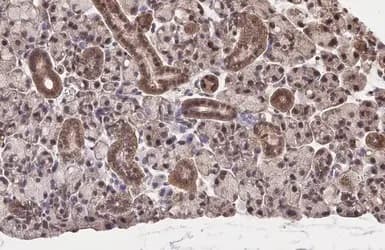 Anti-NRF2 antibody [HL1021] - BSA and Azide free(ab313825)