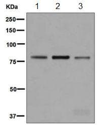 Ltk Antibody Epr51752 Ab129155  Western Blot Img71001