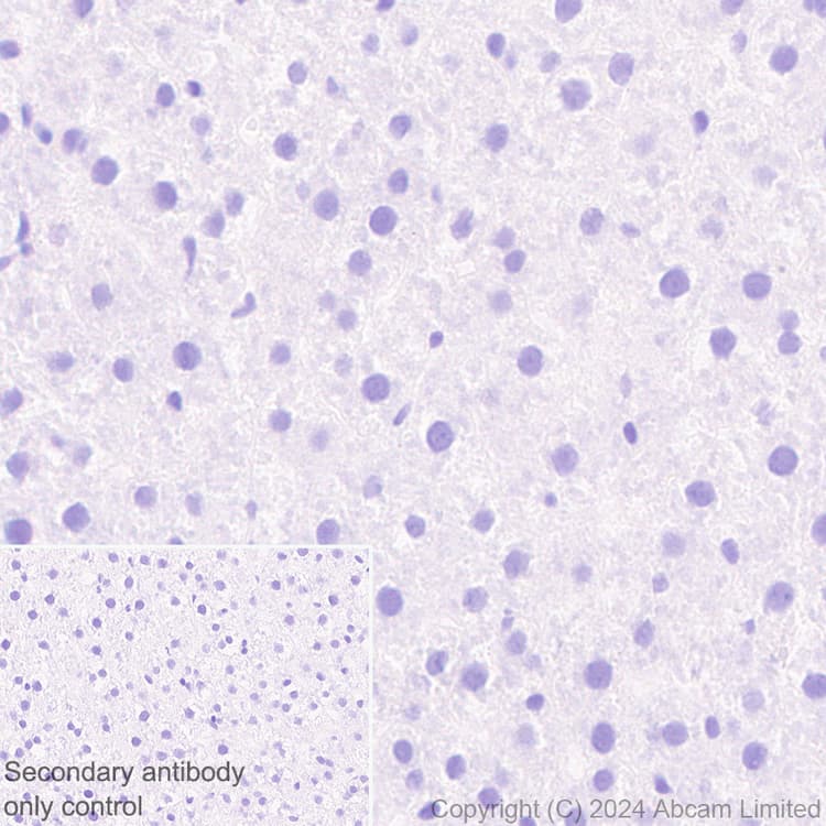 Anti-PADI2 / PAD2 antibody [EPR26940-85](ab322197)
