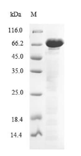 Recombinant Human ENOX2/tNOX protein (Tagged)(AB235678)